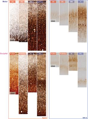 The cortical spectrum: A robust structural continuum in primate cerebral cortex revealed by histological staining and magnetic resonance imaging